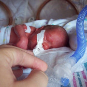 Therapeutic Touch bij veel te vroeg geboren baby's = non-Therapeutic no-Touch 3
