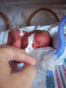 Baby geboren na een zwangerschap van 26 weken en 6 dagen (foto: ceejayoz, CC BY 2.0).