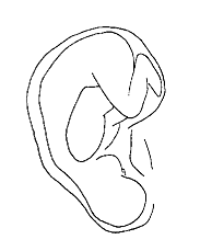 Ooracupuncturisten zien een omgekeerde foetus in de oorschelp. Klachten elders in het lichaam corresponderen met punten op de oorschelp. (afbeelding van http://www.acuwatch.org