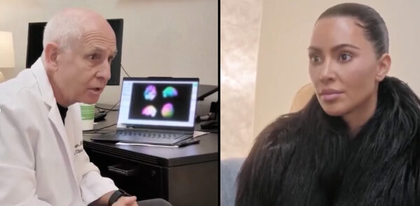 Hersenscan Kim Kardashian toont ‘lage activiteit’ en ‘gaten’, maar klopt dat wel? 1